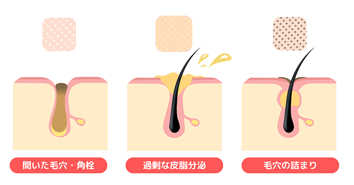 画像:顔を触って悩んでいる女性の画像