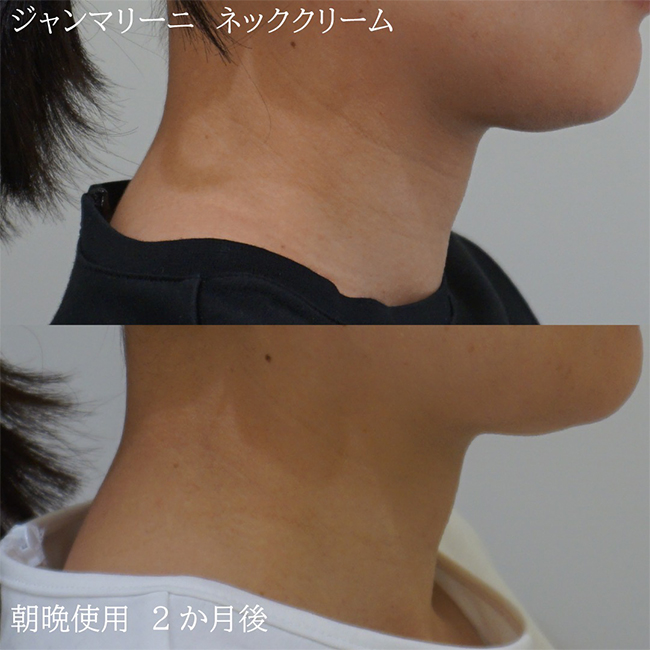 画像：実際に当院で毛穴治療を受けた患者様の症例画像