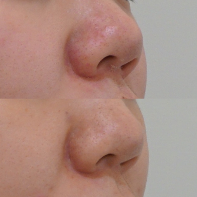 画像：実際にドクターズコスメで治療を受けた患者様の症例画像