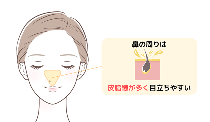 イラスト：鼻の皮脂