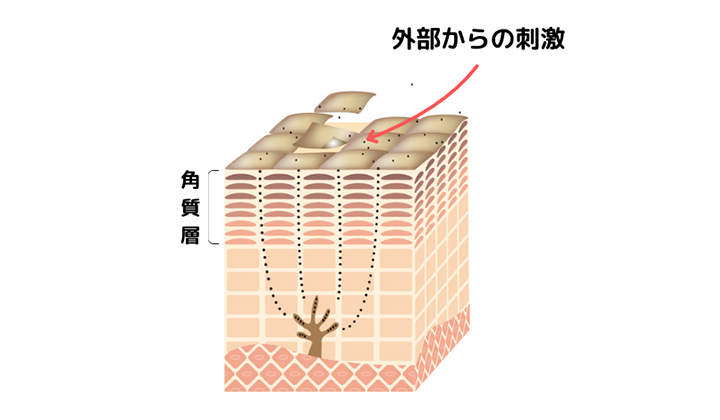 画像：肌断面図