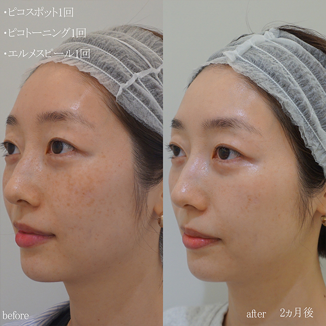 画像：実際にドクターズコスメで治療を受けた患者様の症例画像