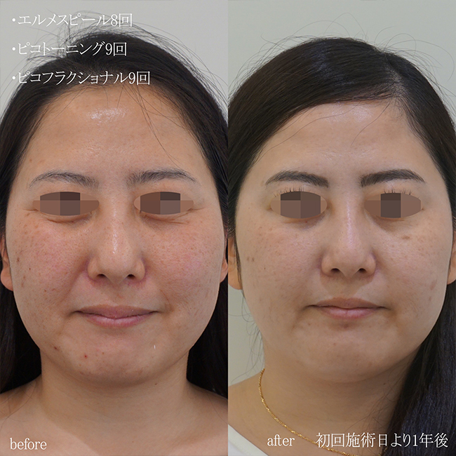 画像：実際にドクターズコスメで治療を受けた患者様の症例画像
