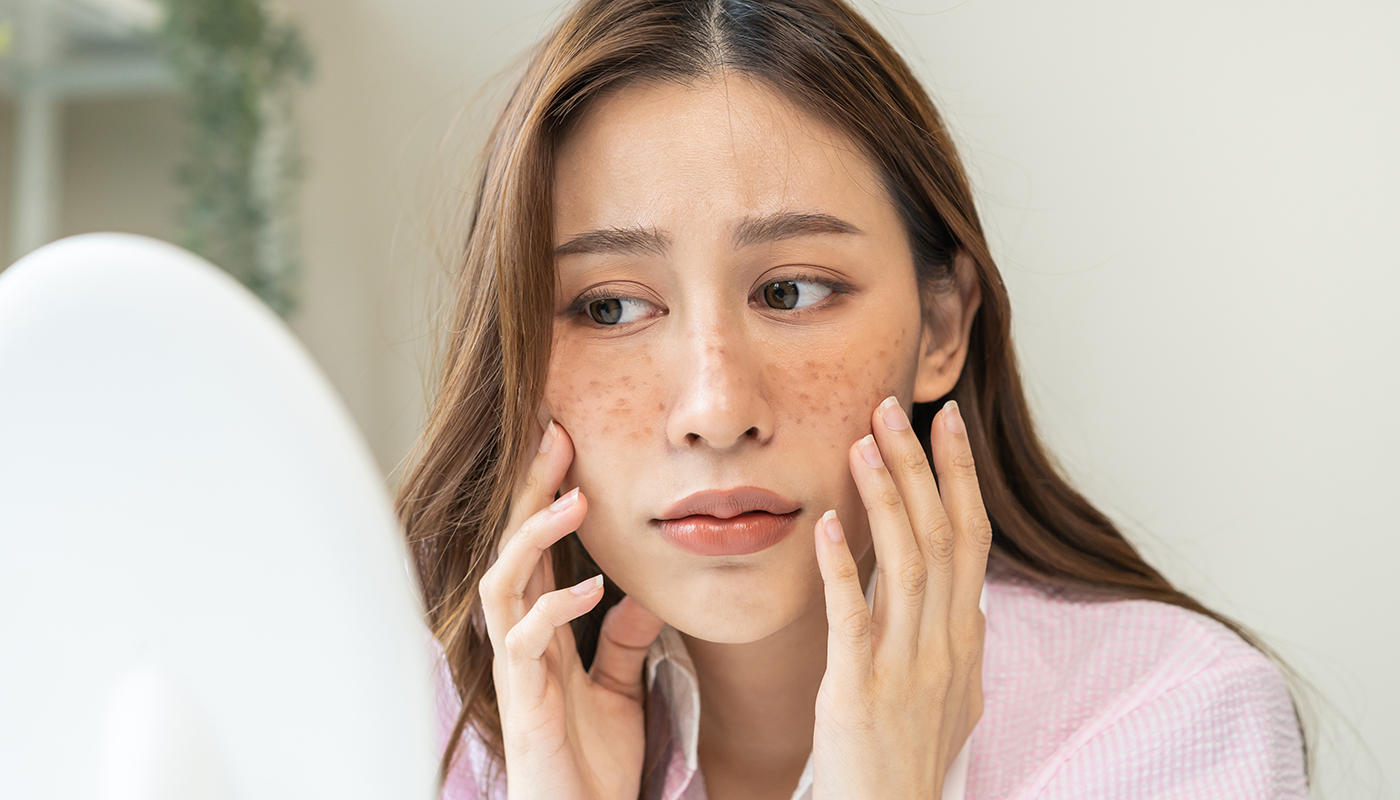 画像：鏡でしみやそばかすを気にする女性
