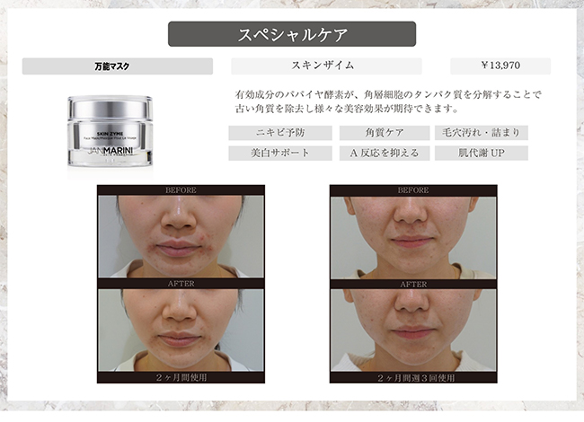 画像：ドクターズコスメの使用